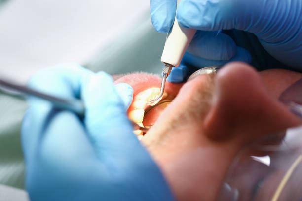 Best Emergency Dentist for Special Needs Patients in Mount Vernon, OH