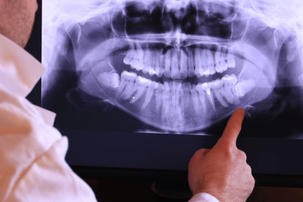 Best Emergency Dentist for Lost Fillings or Crowns in Mount Vernon, OH