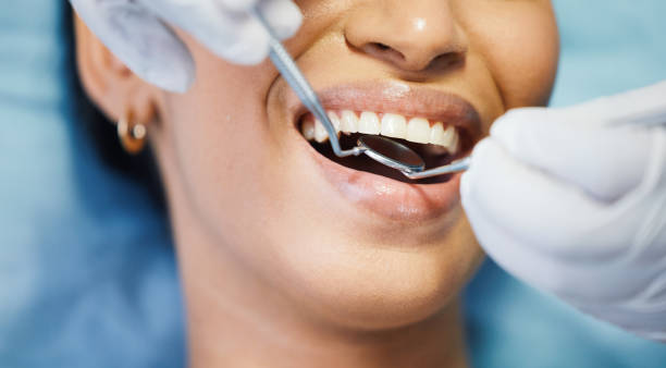 Best Emergency Root Canal Treatment in Mount Vernon, OH